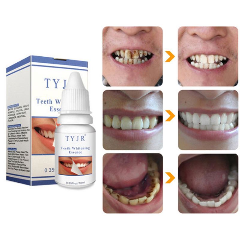 Tekućina Za Izbjeljivanje Zubi Za Uklanjanje Mrlja Od Plaka Žuti Dim Za Čišćenje Oralne Higijene 10 Ml
