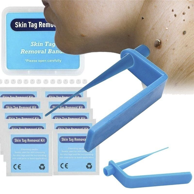 Home Micro Skin Tag Remover Set Traka Za Uklanjanje Bradavica S Kože Srednje Veličine S Tijela